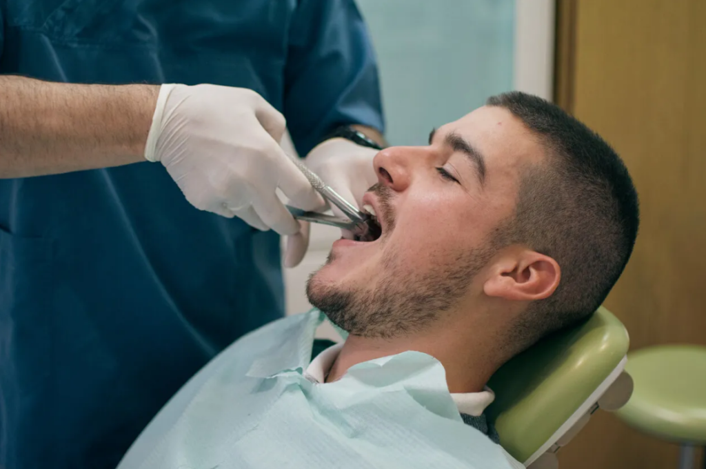 How Long to Keep Gauze in After Tooth Extraction